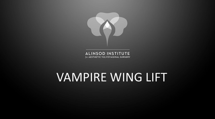 vampire wing lift